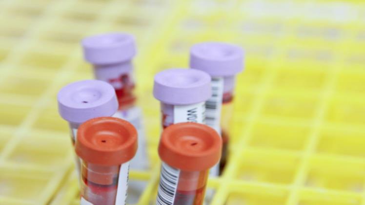 What Your Blood Tests Really Say About Your Health